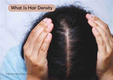 measuring thickness of hair on scalp|hair density on scalp.